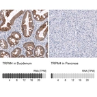 Anti-TRPM4 Antibody