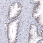 Immunohistochemical staining of human prostate shows moderate membranous positivity in glandular cells.