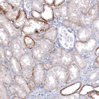 Immunohistochemical staining of human kidney shows moderate to strong membranous positivity in cells in tubules.