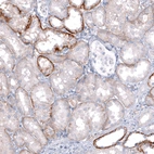 Immunohistochemical staining of human kidney shows moderate to strong membranous positivity in cells in tubules.