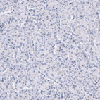Anti-TRPM4 Antibody