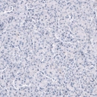 Immunohistochemical staining of human pancreas shows no positivity in exocrine glandular cells as expected.