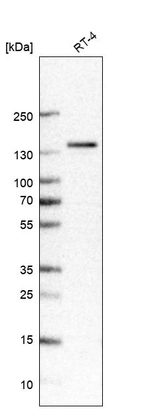 Western blot analysis in human cell line RT-4.