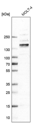 Anti-ITGA4 Antibody