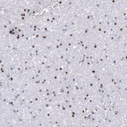 Anti-NKX2-2 Antibody