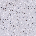 Immunohistochemical staining of human Cerebral cortex shows strong nuclear positivity in neuronal and glial cells.
