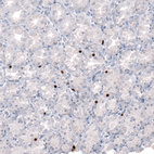 Immunohistochemical staining of human Stomach shows strong nuclear positivity in enteroendocrine cells.