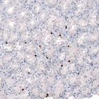 Immunohistochemical staining of human Stomach shows strong nuclear positivity in enteroendocrine cells.