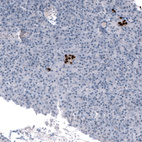 Anti-NKX2-2 Antibody