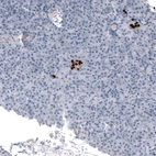 Immunohistochemical staining of human Pancreas shows strong nuclear positivity in islets of Langerhans.