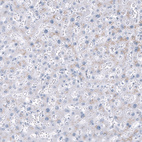 Immunohistochemical staining of human Liver shows no positivity in hepatocytes as expected.