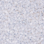 Immunohistochemical staining of human Liver shows no positivity in hepatocytes as expected.