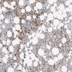 Immunohistochemical staining of human Bone marrow shows strong membranous positivity in hematopoietic cells.