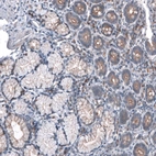 Immunohistochemical staining of human Small intestine shows moderate membranous positivity in glandular cells.