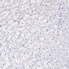 Immunohistochemical staining of human Liver shows no positivity in hepatocytes as expected.