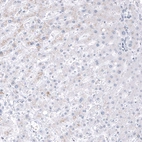 Immunohistochemical staining of human Liver shows no positivity in hepatocytes as expected.