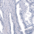 Immunohistochemical staining of human Prostate shows no positivity in glandular cells as expected.