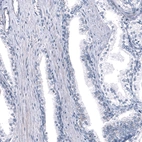 Immunohistochemical staining of human Prostate shows no positivity in glandular cells as expected.