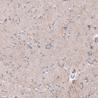 Immunohistochemical staining of human Cerebral cortex shows moderate positivity in neuronal processes in neuropil.