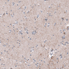 Anti-P2RX7 Antibody