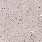 Immunohistochemical staining of human Cerebral cortex shows moderate positivity in neuronal processes in neuropil.