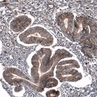 Immunohistochemical staining of human Endometrium shows strong membranous positivity in glandular cells.