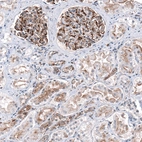 Immunohistochemical staining of human Kidney shows strong membranous positivity in cells in glomeruli and tubules.