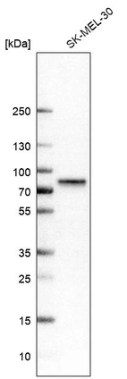 Western blot analysis in human cell line SK-MEL-30.