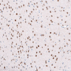 Anti-TCF7L2 Antibody