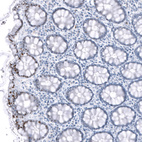 Immunohistochemical staining of human rectum shows moderate nuclear positivity in glandular cells.