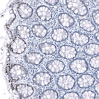 Anti-TCF7L2 Antibody