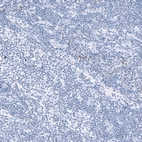 Immunohistochemical staining of human lymph node shows very weak nuclear positivity in non-germinal center cells.