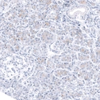 Immunohistochemical staining of human pancreas shows no nuclear positivity in exocrine glandular cells and islets of Langhernas.