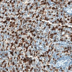 Immunohistochemical staining of human spleen shows strong granular cytoplasmic positivity in cells in red pulp.