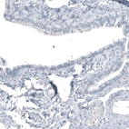 Immunohistochemical staining of human fallopian tube shows no positivity in glandular cells as expected.