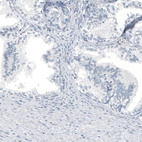 Anti-HMOX1 Antibody