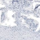 Immunohistochemical staining of human prostate shows no positivity in glandular cells as expected.
