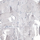 Immunohistochemical staining of human skeletal muscle shows no positivity in myocytes as expected.