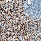 Immunohistochemical staining of human spleen shows strong granular cytoplasmic positivity in cells in red pulp.