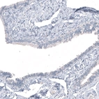 Immunohistochemical staining of human fallopian tube shows no positivity in glandular cells as expected.