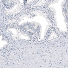 Immunohistochemical staining of human prostate shows no positivity in glandular cells as expected.