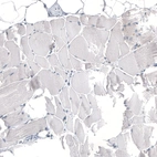 Immunohistochemical staining of human skeletal muscle shows no positivity in myocytes as expected.