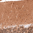 Immunohistochemical staining of human cerebellum shows strong nuclear positivity in cells in molecular layer.