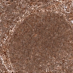 Immunohistochemical staining of human lymph node shows strong cytoplasmic and nuclear positivity in non-germinal center cells.