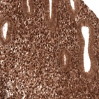 Immunohistochemical staining of human endometrium shows strong nuclear positivity in stromal cells.