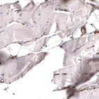 Immunohistochemical staining of human skeletal muscle shows no positivity in myocytes as expected.