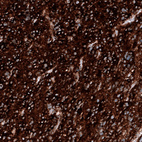 Anti-PTEN Antibody