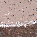 Immunohistochemical staining of human cerebellum shows strong nuclear positivity in cells in molecular layer.