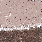 Immunohistochemical staining of human cerebellum shows strong nuclear positivity in cells in molecular layer.