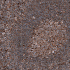 Immunohistochemical staining of human tonsil shows moderate to strong cytoplasmic positivity in germinal center cells.